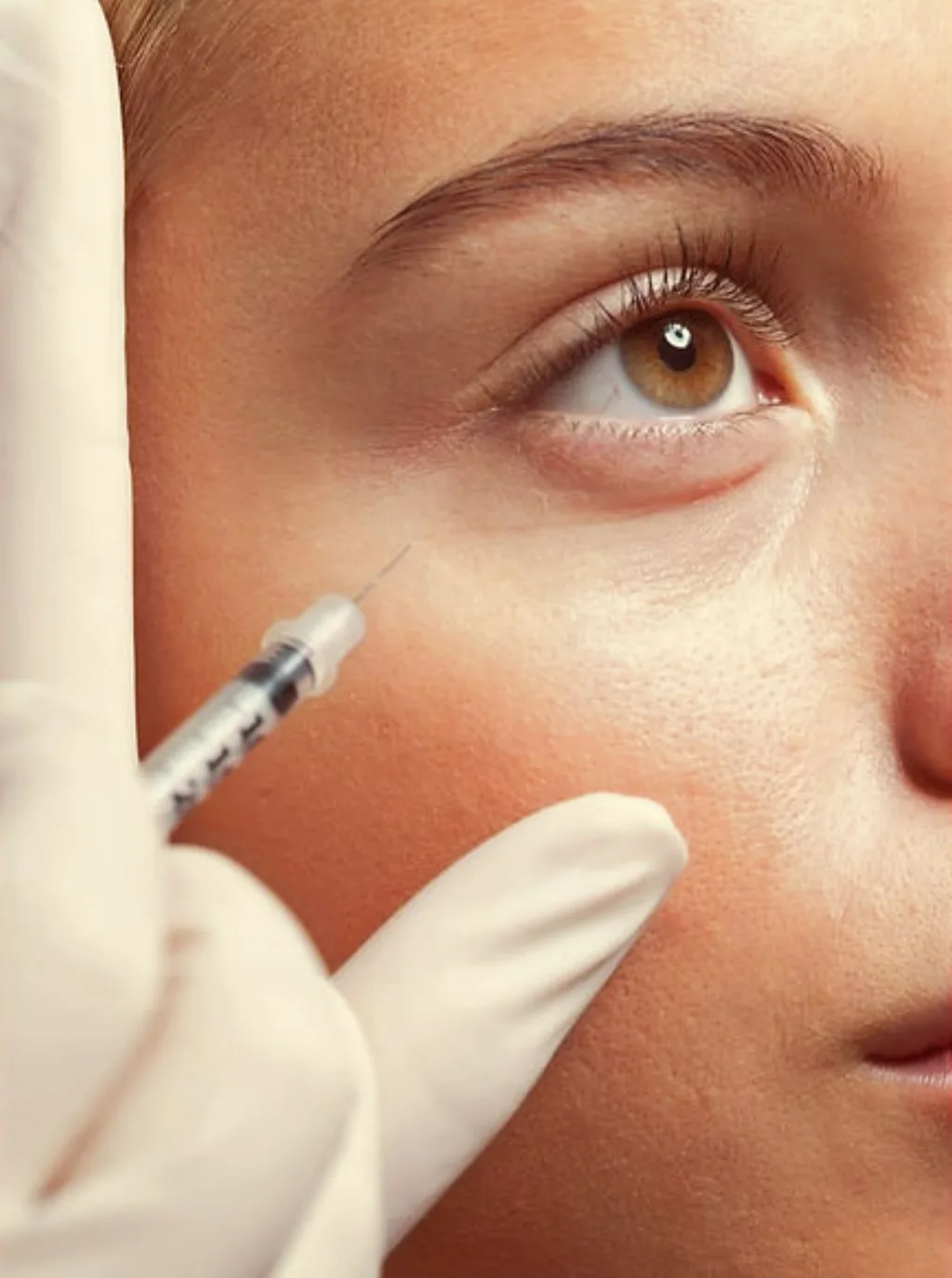 Wrinkle Reducing Treatment